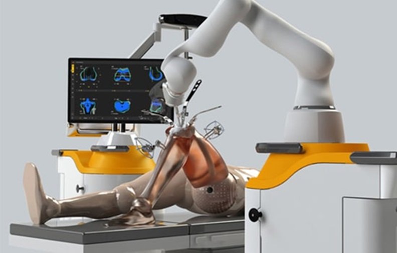 The Revolution of Robotic Knee Replacement Surgery